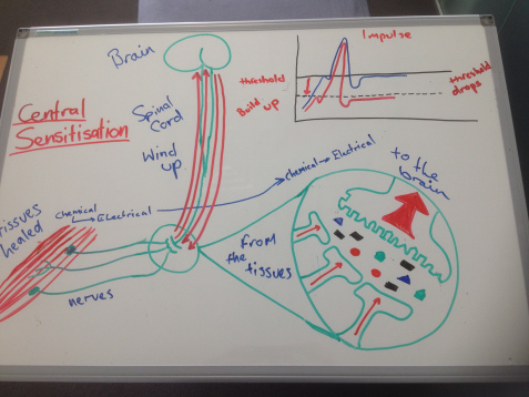 central sensitisation