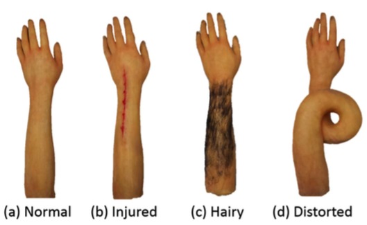 When is CRPS,?CRPS?